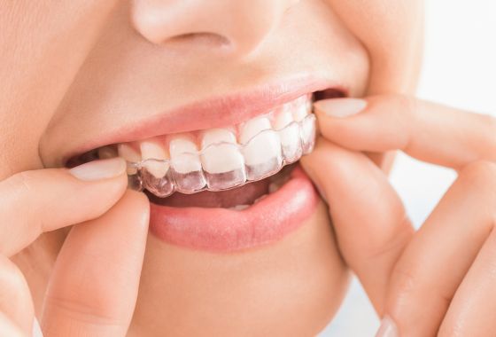 blanqueamiento dental en casa