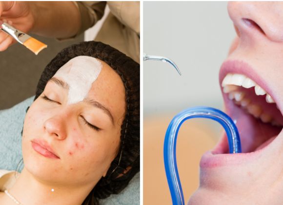 limpieza facial y dental